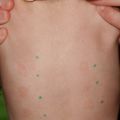 Nya allergier... :-(
