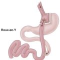 Gastric Bypass = Undernärd = Hjärnskador